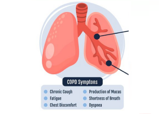 COPD Treatments